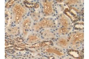 Detection of HSPA1A in Human Kidney Tissue using Polyclonal Antibody to Heat Shock 70 kDa Protein 1A (HSPA1A)