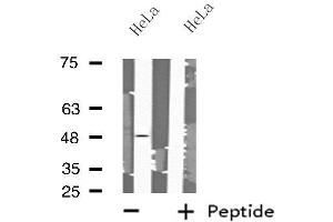 Western blot analysis of extracts from HeLa cells using MRPS27 antibody. (MRPS27 anticorps  (N-Term))