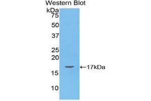 Western blot analysis of the recombinant protein. (ANGPTL4 anticorps  (AA 286-409))