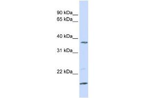 ZDHHC19 antibody used at 1 ug/ml to detect target protein.
