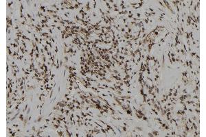 ABIN6261384 and ABIN6274008 at 1/100 staining Human gastric tissue by IHC-P.