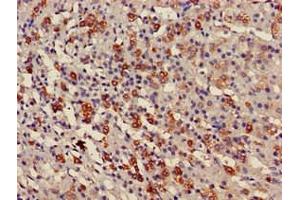 Immunohistochemistry of paraffin-embedded human adrenal gland tissue using ABIN7175158 at dilution of 1:100 (USP6NL anticorps  (N-Term))