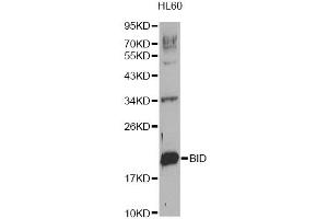 Western blot analysis of extracts of HL-60 cells, using BID Antibody (ABIN1871288). (BID anticorps)