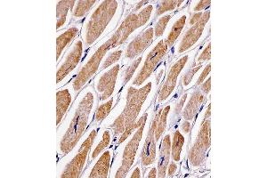 C staining MFN2 in human heart tissue sections by Immunohistochemistry (IHC-P - paraformaldehyde-fixed, paraffin-embedded sections).