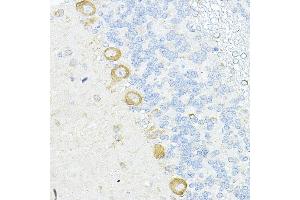 Immunohistochemistry of paraffin-embedded rat cerebellum using RPL10A Rabbit pAb (ABIN6129099, ABIN6147103, ABIN6147104 and ABIN6221624) at dilution of 1:100 (40x lens).