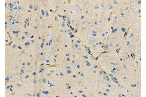 ABIN6258945 and ABIN6275115 at 1/100 staining Mouse brain tissue by IHC-P.