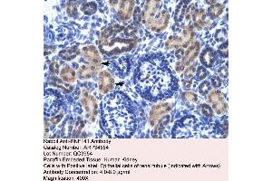 Human kidney (RNF141 anticorps  (Middle Region))