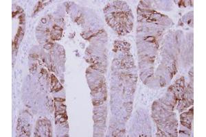 Image no. 1 for anti-AChE Q Subunit (COLQ) (AA 248-455) antibody (ABIN1497560)