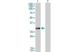 Western Blot analysis of MGC40579 expression in transfected 293T cell line by MGC40579 monoclonal antibody (M11), clone 2C11. (GK5 anticorps  (AA 1-89))
