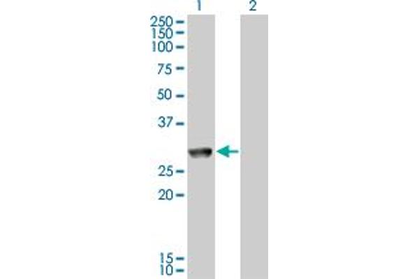 GK5 anticorps  (AA 1-89)