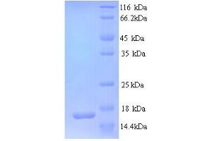 SDS-PAGE (SDS) image for Glutamate Receptor, Ionotropic, AMPA 3 (GRIA3) (AA 151-250), (partial) protein (His tag) (ABIN5713486)