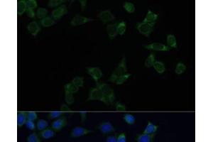 Immunofluorescence analysis of HeLa cells using SS18L1 Polyclonal Antibody at dilution of 1:100. (SS18L1 anticorps)