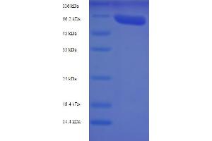 SDS-PAGE (SDS) image for Vascular Endothelial Growth Factor A (VEGFA) (AA 51-511) protein (His-SUMO Tag) (ABIN5710612)