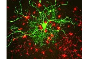 Immunostaining of cultured rat neurons with anti-mouse neurofilament L (green) and anti-rabbit alpha internexin. (NEFL anticorps)