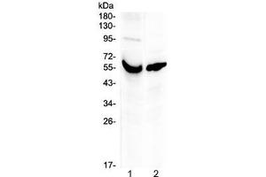 Western blot testing of human 1) placenta and 2) A431 lysate with VDBP antibody at 0. (Vitamin D-Binding Protein anticorps)