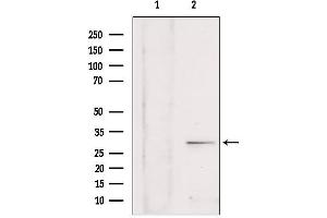 Western blot analysis of extracts from rat brain, using SULT4A1 antibody. (SULT4A1 anticorps  (C-Term))