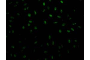 Immunofluorescence staining of Hela Cells with ABIN7127661 at 1:50, counter-stained with DAPI.