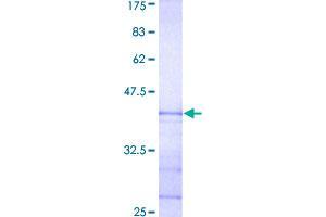Image no. 1 for Stanniocalcin 1 (STC1) (AA 141-247) protein (GST tag) (ABIN1321618)