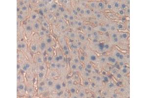 IHC-P analysis of Mouse Tissue, with DAB staining. (IL-6 Receptor anticorps  (AA 205-347))