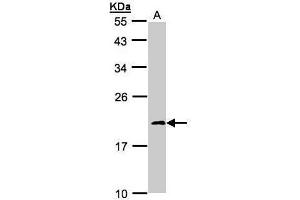 WB Image Sample(30μg whole cell lysate) A: 293T 12% SDS PAGE antibody diluted at 1:1000
