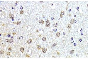 Immunohistochemistry of paraffin-embedded Rat brain using SUMO1 Polyclonal Antibody at dilution of 1:200 (40x lens). (SUMO1 anticorps)