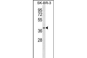 SFXN3 Antibody (C-term) (ABIN1537061 and ABIN2849990) western blot analysis in SK-BR-3 cell line lysates (35 μg/lane). (SFXN3 anticorps  (C-Term))