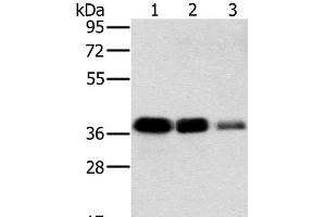 Western Blot analysis of A549, HT-29 and A172 cell using MTFR1 Polyclonal Antibody at dilution of 1:500 (MTFR1 anticorps)