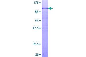 Image no. 1 for Protein Regulator of Cytokinesis 1 (PRC1) (AA 1-620) protein (GST tag) (ABIN1316131)