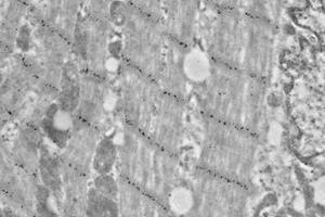 Immunoelectron microscopy analysis of LR white resin-embedded mouse heart using alpha Actinin 2 (ABIN7075510) at dilution of 1: 50. (Sarcomeric alpha Actinin anticorps)