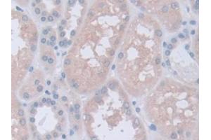 DAB staining on IHC-P; Samples: Human Kidney Tissue