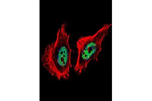 Fluorescent confocal image of Hela cell stained with CTBP1 Antibody . (CTBP1 anticorps  (C-Term))