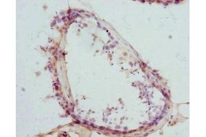 Immunohistochemistry of paraffin-embedded human testis tissue using ABIN7145457 at dilution of 1:100