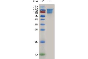 Mouse CD34 Protein, hFc Tag on SDS-PAGE under reducing condition.