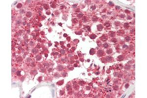 Anti-CILD9 / DNAI2 antibody IHC staining of human testis. (DNAI2 anticorps  (AA 71-120))