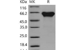 Western Blotting (WB) image for Activin RIIA / ACVR2A (Active) protein (His tag,Fc Tag) (ABIN7194141)