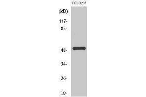 Western Blotting (WB) image for anti-Protein Phosphatase 4, Regulatory Subunit 1-Like (PPP4R1L) (Internal Region) antibody (ABIN3186544)