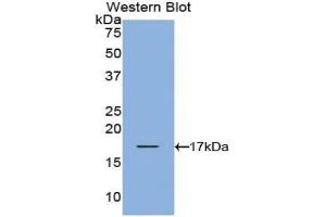Western blot analysis of the recombinant protein. (TCL1A anticorps  (AA 1-114))