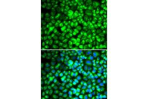 Immunofluorescence analysis of U2OS cells using ATP5A1 antibody.