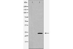 Western blot analysis of Hepg2 whole cell lysates, using VHL  Antibody. (VHL anticorps  (Internal Region))