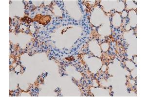 ABIN6267471 at 1/200 staining Mouse lung tissue sections by IHC-P. (AKT1 anticorps  (pSer124))