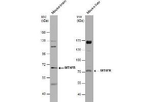 WB Image Various tissue extracts (50 μg) were separated by 7. (MTHFR anticorps)