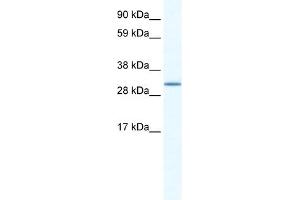 WB Suggested Anti-SPIC Antibody Titration:  1. (SPIC anticorps  (N-Term))