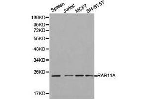 Western Blotting (WB) image for anti-RAB11A, Member RAS Oncogene Family (RAB11A) antibody (ABIN1874497) (RAB11A anticorps)