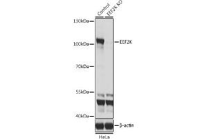 Western blot analysis of extracts from normal (control) and EEF2K knockout (KO) HeLa cells, using EEF2K antibody (ABIN6130354, ABIN6139955, ABIN6139956 and ABIN7101771) at 1:1000 dilution. (EEF2K anticorps  (AA 406-725))