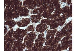 Image no. 3 for anti-B and T Lymphocyte Associated (BTLA) antibody (ABIN1496981)