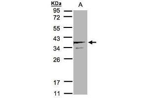 WB Image Sample(30 μg of whole cell lysate) A:MOLT4, 12% SDS PAGE antibody diluted at 1:2000 (SCAMP3 anticorps)