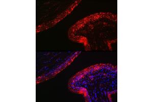 Immunofluorescence analysis of mouse skin using Cytokeratin 16 (KRT16) Rabbit pAb (ABIN6129541, ABIN6143021, ABIN6143022 and ABIN6223391) at dilution of 1:200 (40x lens). (KRT16 anticorps  (AA 190-430))