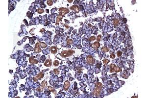 anti-Estrogen Receptor 1 (ESR1) (AA 331-360) antibody