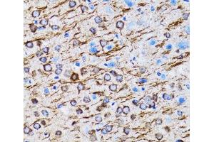 Immunohistochemistry of paraffin-embedded Rat brain using MAP1LC3A Polyclonal Antibody at dilution of 1:100 (40x lens). (MAP1LC3A anticorps)