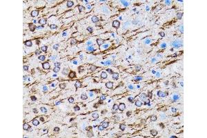 Immunohistochemistry of paraffin-embedded Rat brain using MAP1LC3A Polyclonal Antibody at dilution of 1:100 (40x lens).
